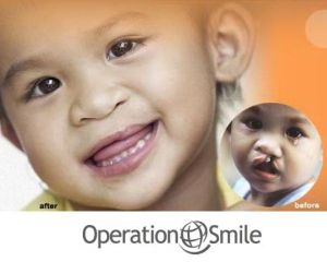 Strategic Campaigns Inc Operation Smile
